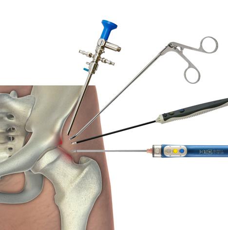 Types Of Procedures Used In Orthopedic Surgery