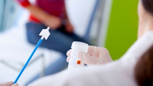 Preventing Cervical Cancer With Pap Smear Test